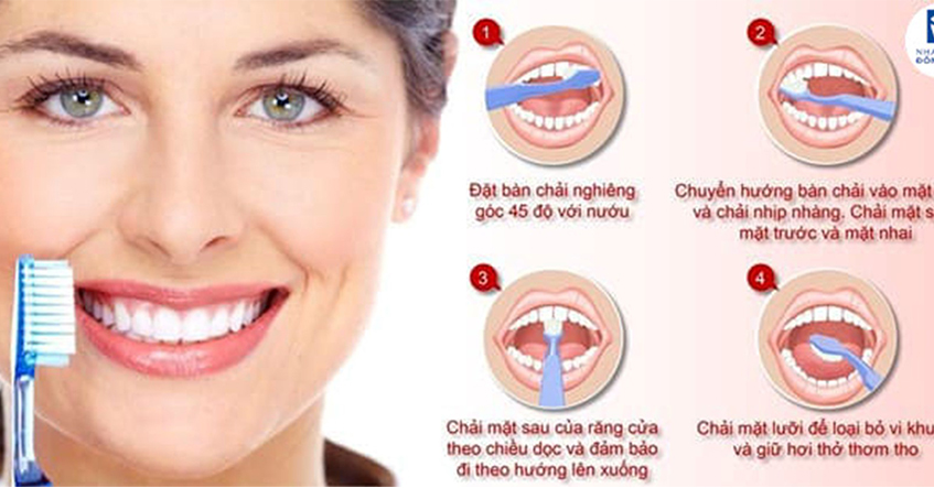 MỌI ĐIỀU BẠN CẦN BIẾT VỀ MẢNG BÁM RĂNG