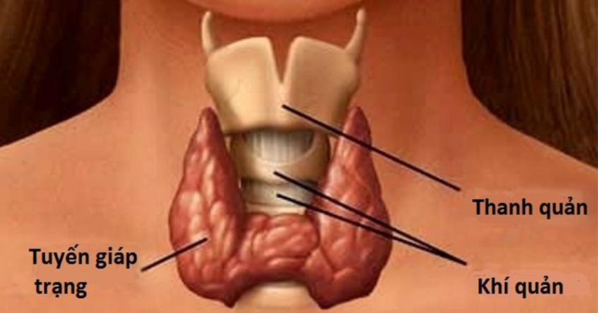 Phẫu thuật cắt thanh quản toàn phần
