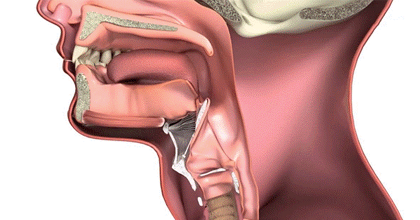 Những phương pháp điều trị ung thư thanh quản